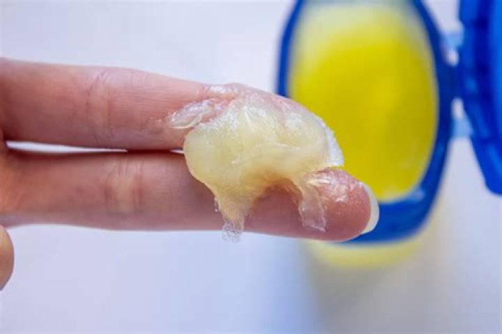 Can I put Vaseline on my surgical incision?