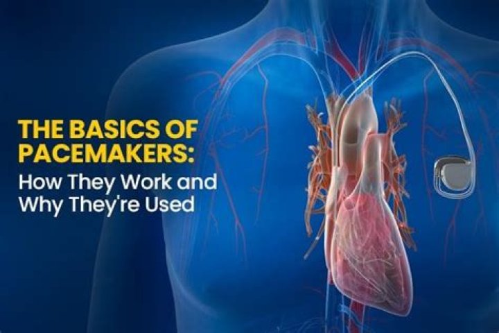 Can you drive if you have pacemaker?