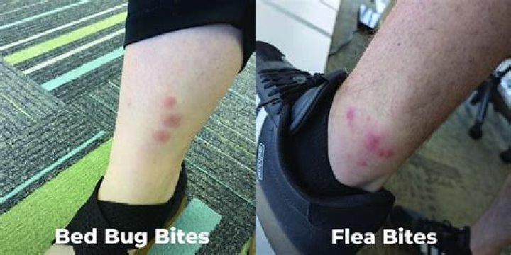 Can you feel a bed bug biting you?