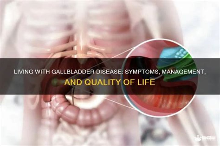 Can you live with gallbladder disease?