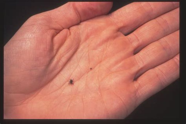 Can you see scabies mites?