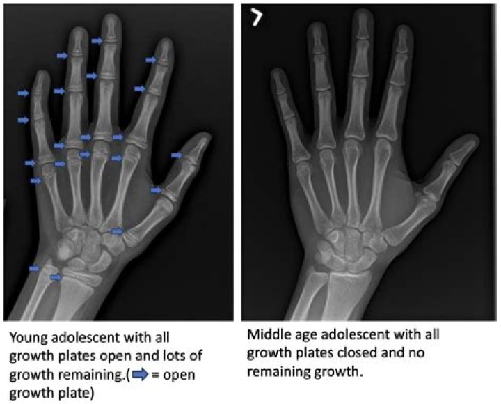 Can you tell age from hands?