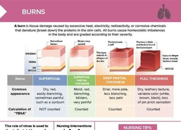 Do 5th or 6th degree burns exist?