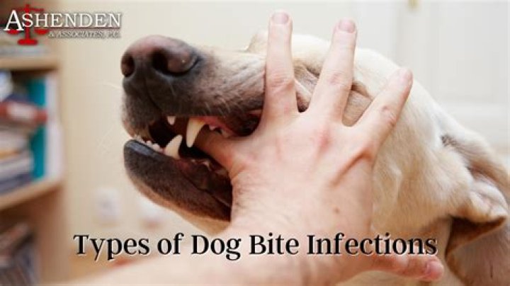 Do all dog bites get infected?