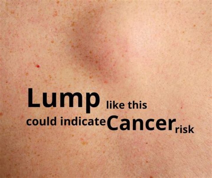 Do cancerous lumps hurt?