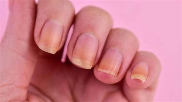 Do finger nails have germs?