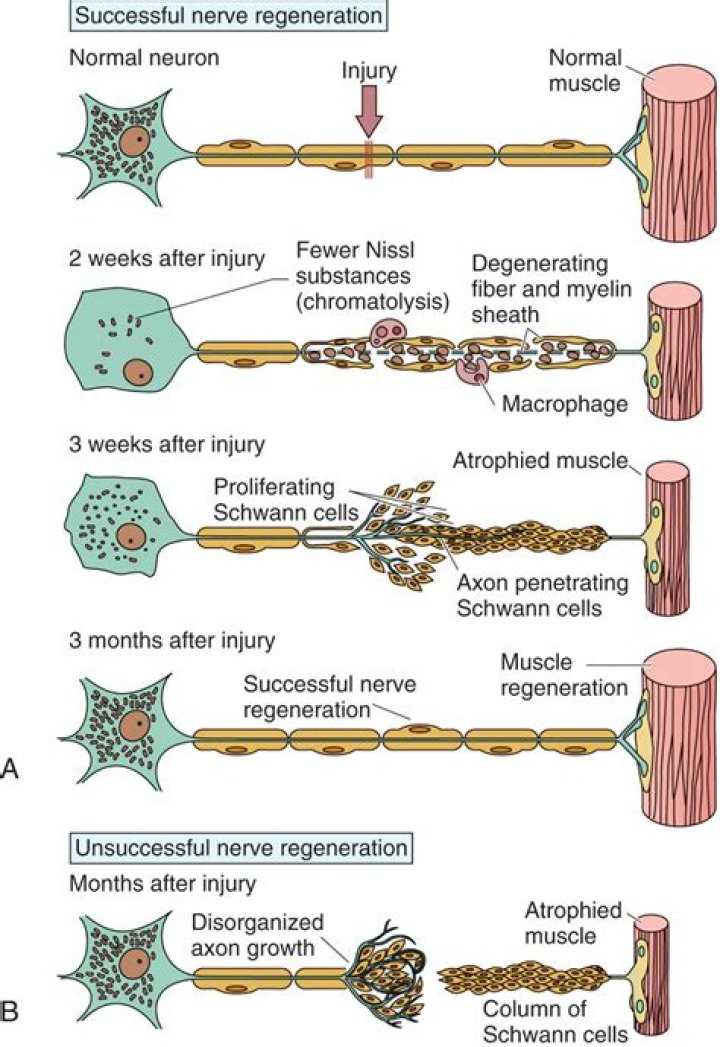 Do nerves regenerate after a stroke?