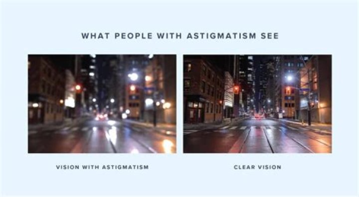 Do people with astigmatism see lines in lights?