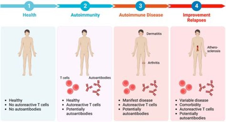 Do you gain weight with autoimmune disease?