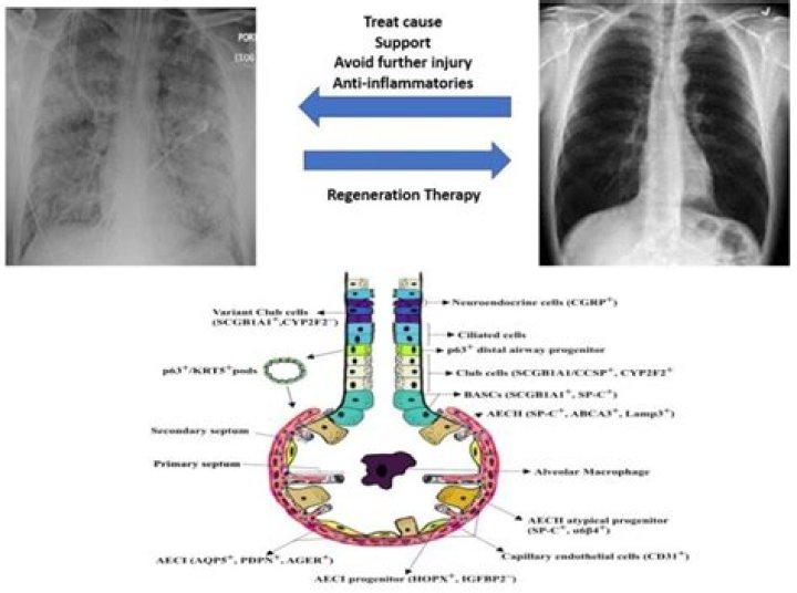 Do your lungs regenerate after 7 years?