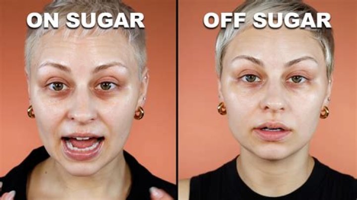 Does eating sugar make you look older?