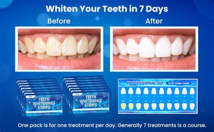 Does gum make teeth whiter?