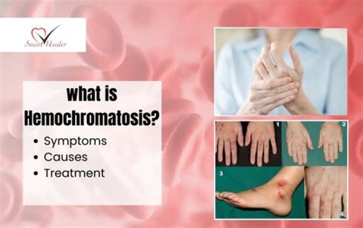 Does hemochromatosis cause swollen ankles?