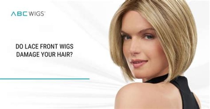 Does lace front wigs damage hairline?