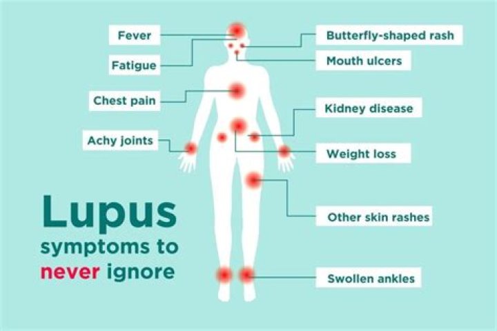Does lupus affect sleep?