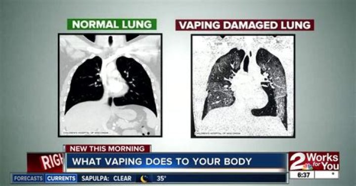 Does vaping help with sleep?