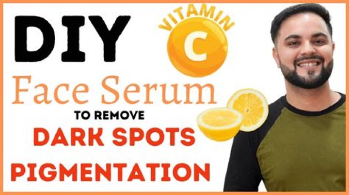 Does vitamin C remove dark spots?