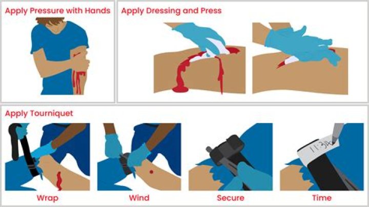 How do I stop bleeding on my tongue?