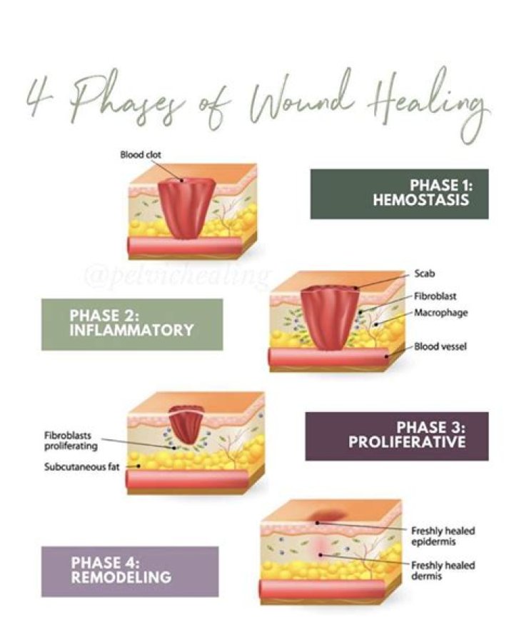 How do you treat internal scar tissue?