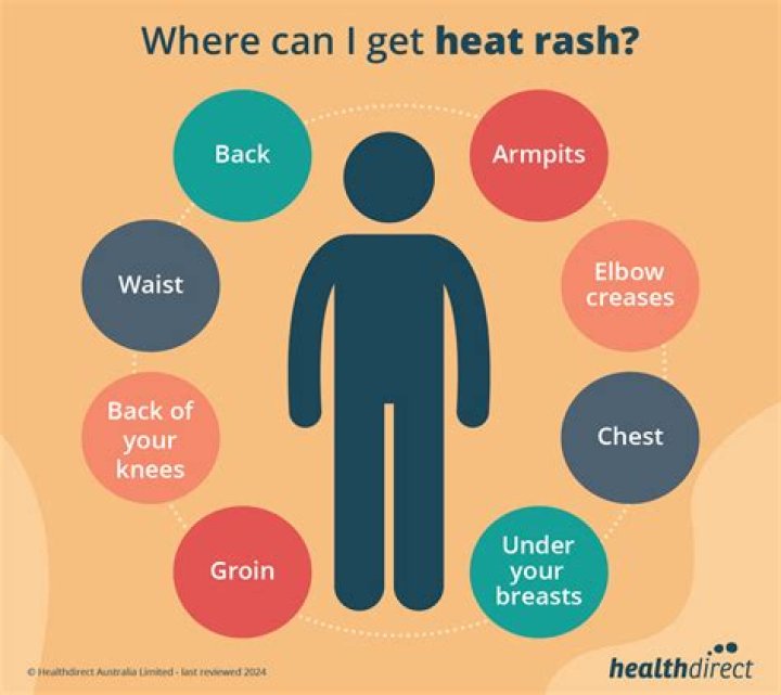 How does heat rash spread?