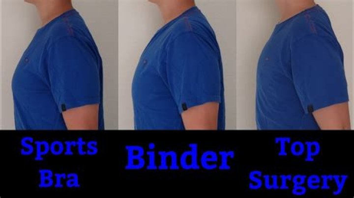 How long do I have to wear a binder after top surgery?