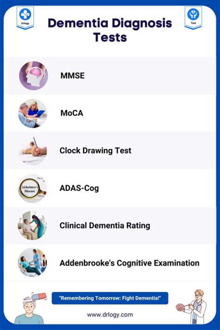 How long does a memory test take for dementia?