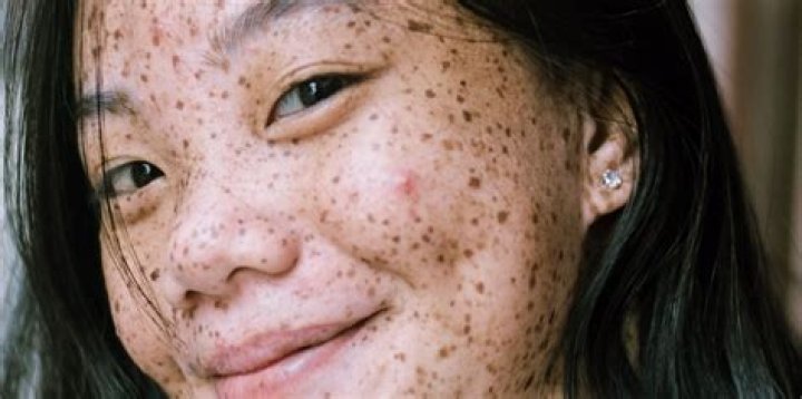 How long does the retinol uglies last?