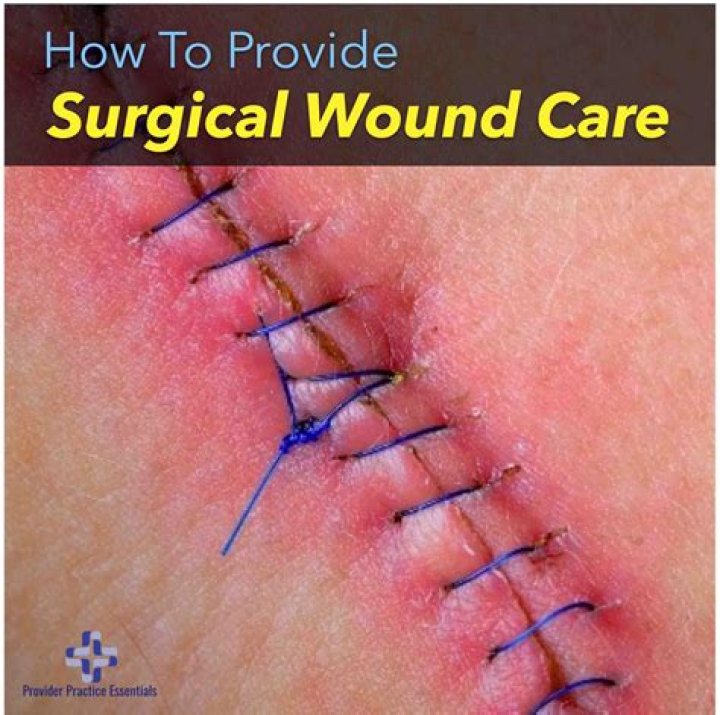 How long should a surgical wound take to heal?
