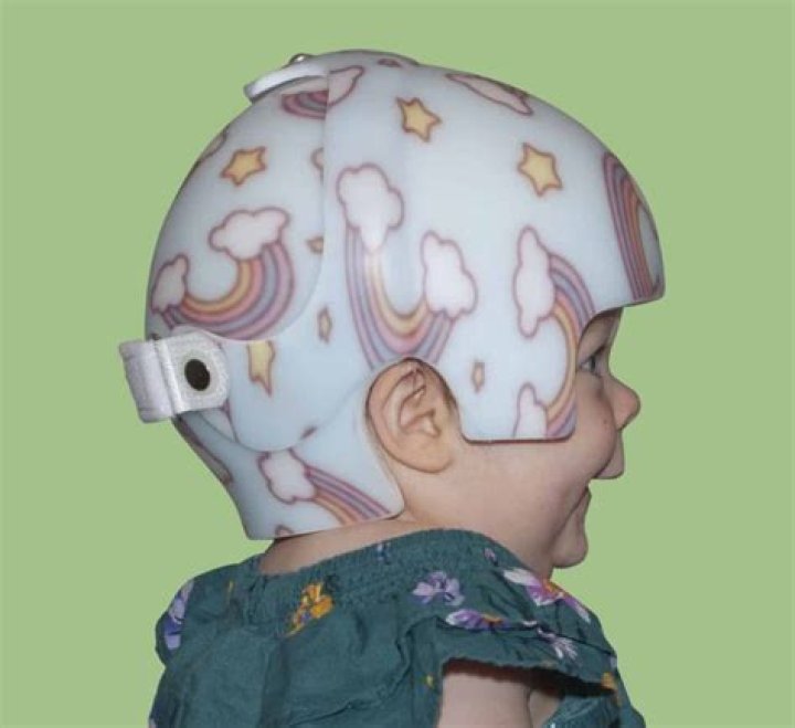 How much does a cranial helmet cost?
