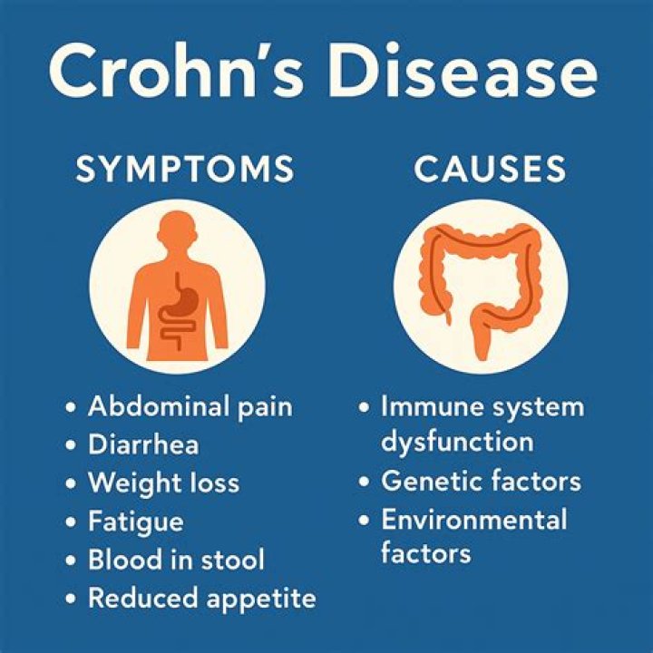 How often do you poop with Crohn's disease?