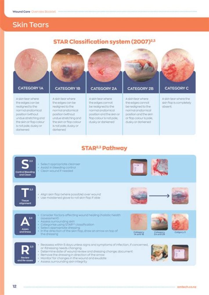 Is a skin tear a stage 2?