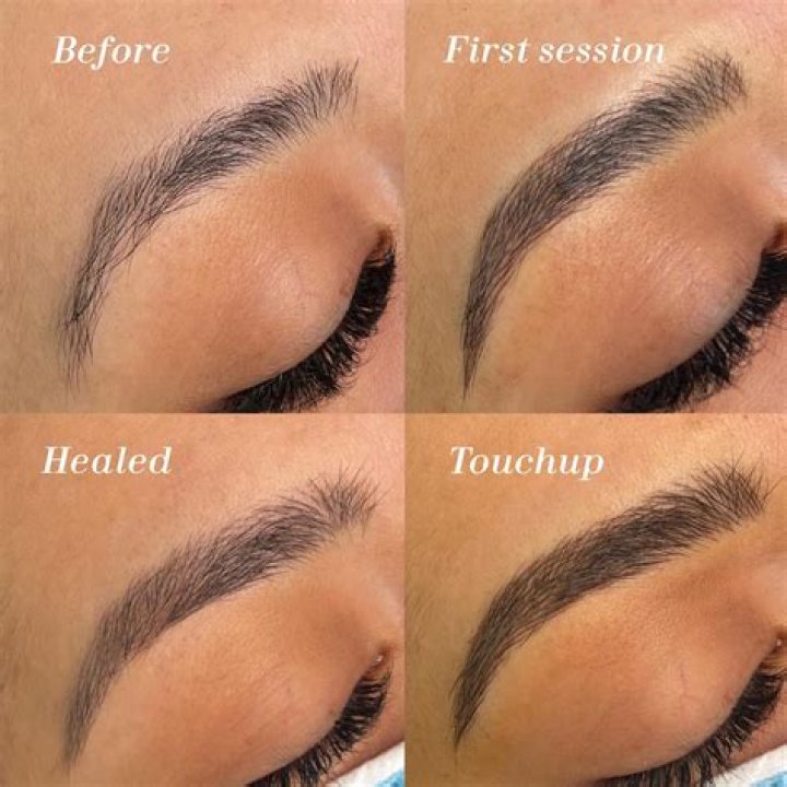 Is Bleeding After microblading normal?
