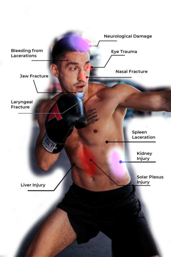 Is boxing too violent?