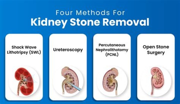 Is removing a kidney a big operation?