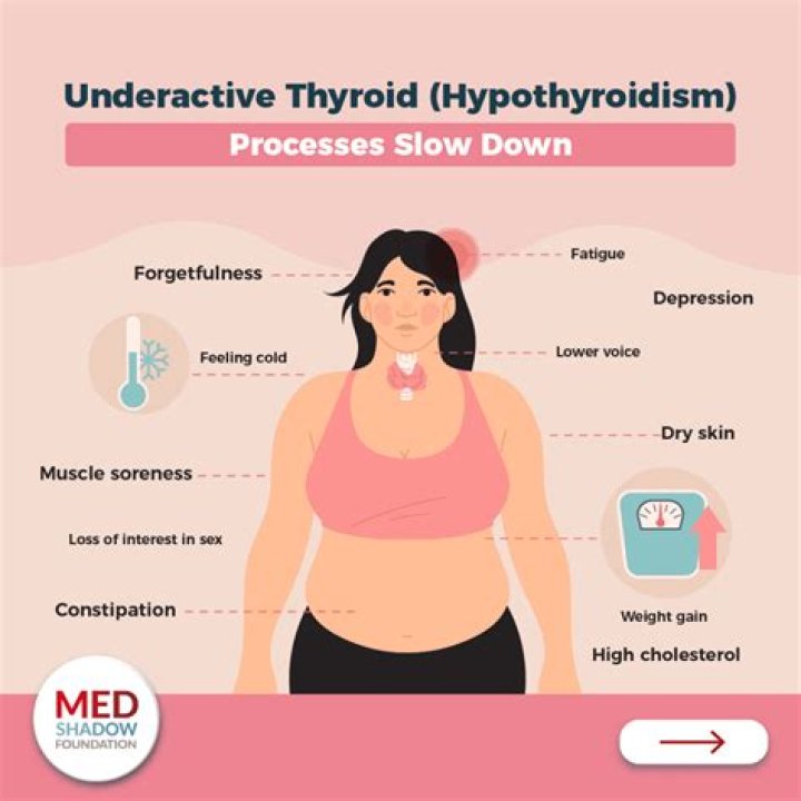 Is spinach good for hypothyroidism?
