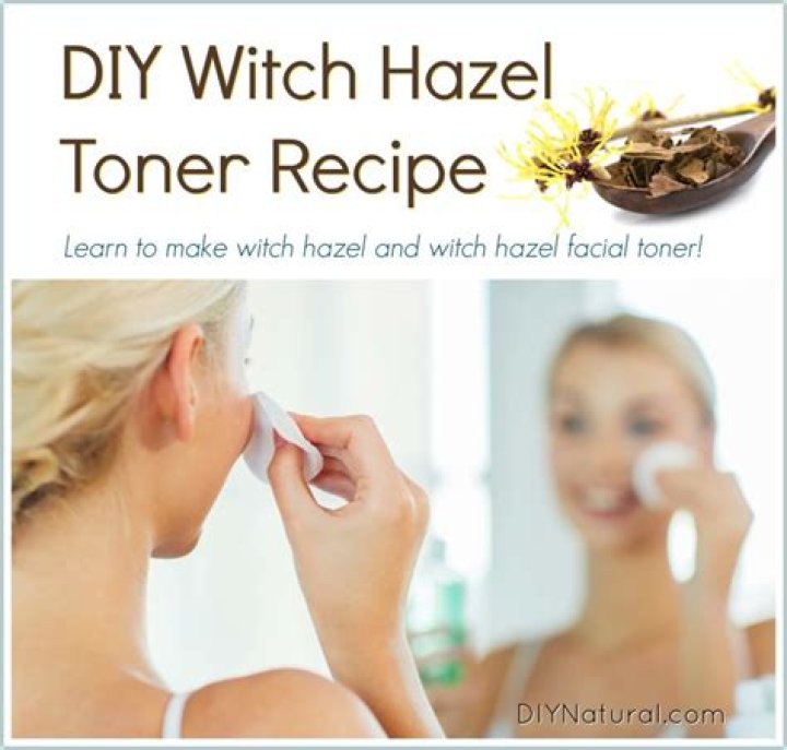 Is witch hazel a toner?