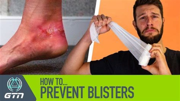 Should I get blisters from golf?