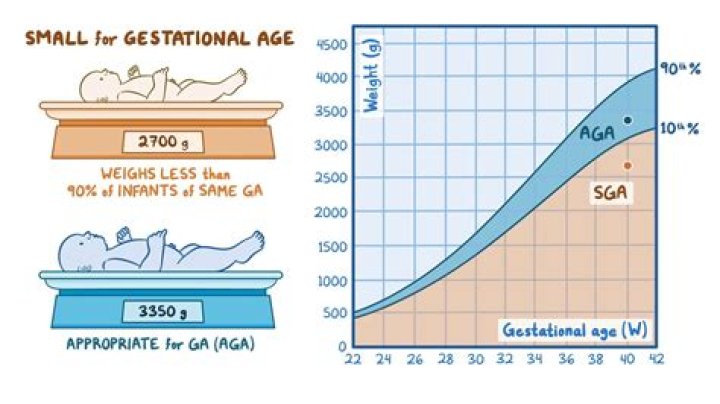 What's a good age to get BBL?
