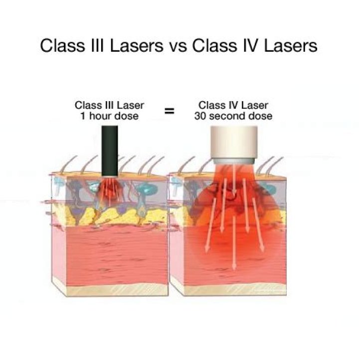 What are Class 4 lasers used for?