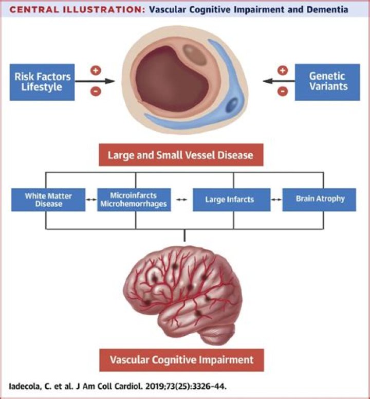 What are the 3 stages of vascular dementia?