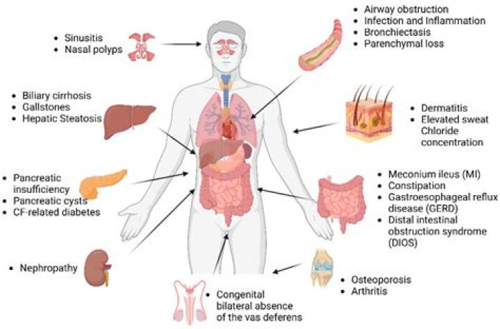 What body systems are affected by kidney failure?