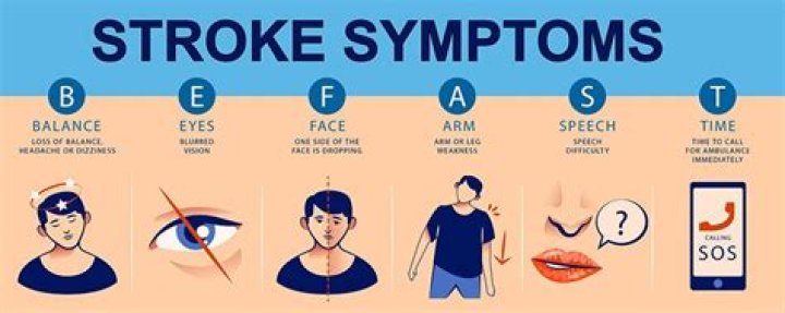 What can cause stroke symptoms but not be a stroke?