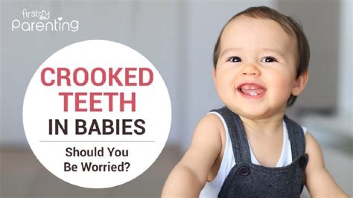 What causes babies not to talk?