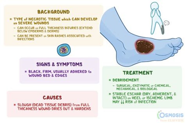 What does eschar tissue look like?