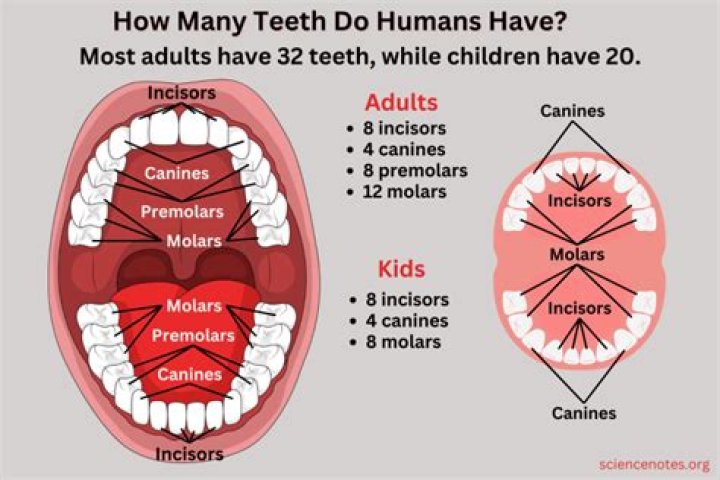What does too many teeth mean?