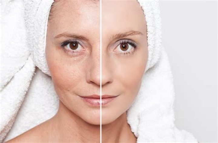 What improves skin texture?