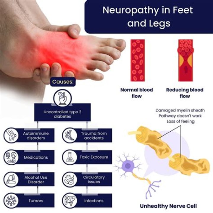 What is the best treatment for neuropathy?