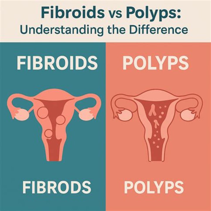 What is worse fibroids or polyps?