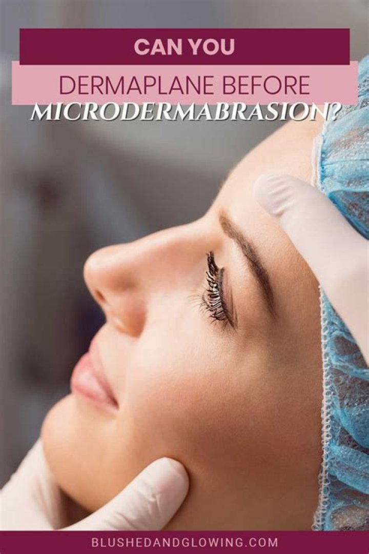 What should you not do before microdermabrasion?