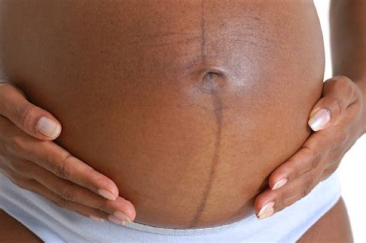 When does pregnancy line on stomach appear?